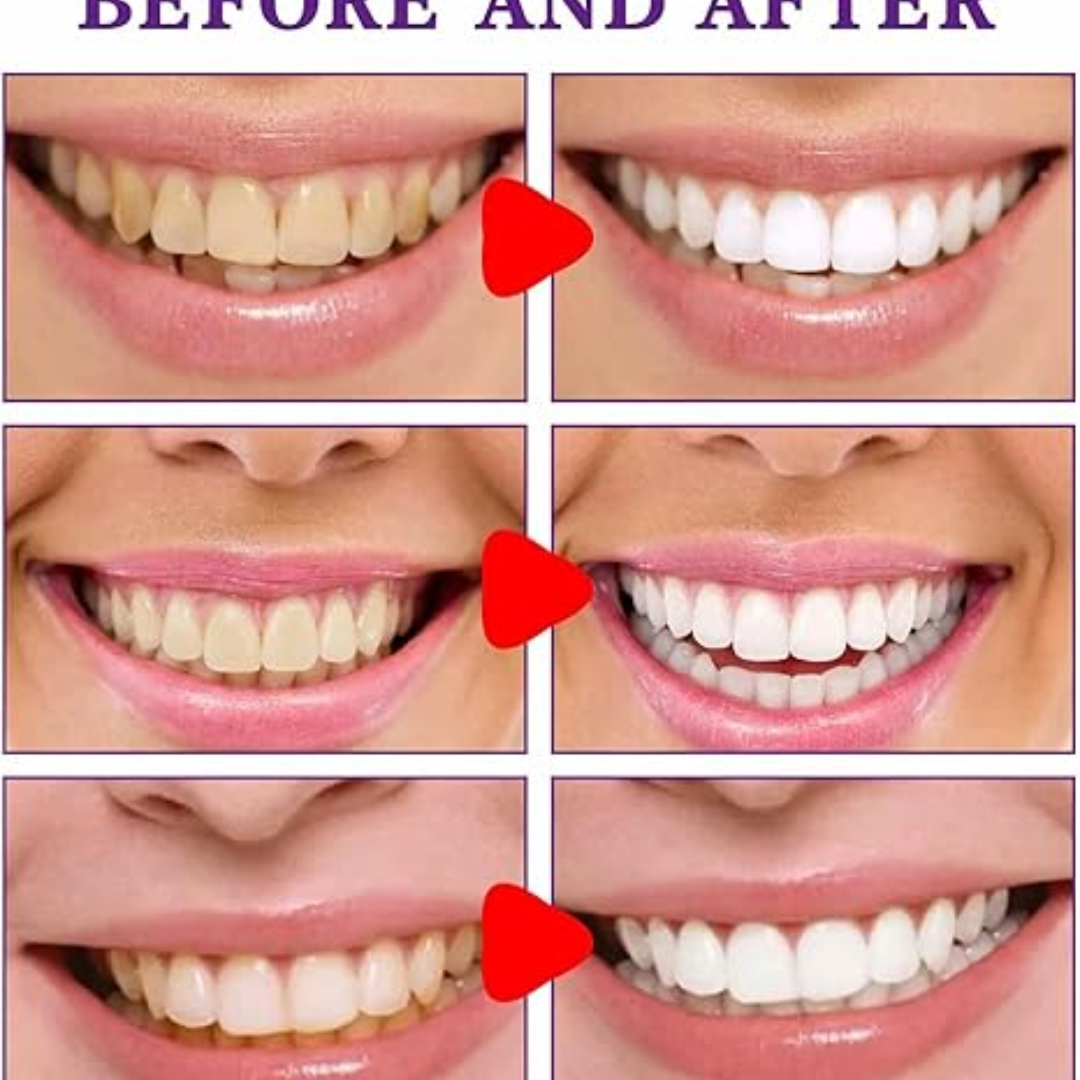 Miniatura 4 de CREMA BLANQUEADORA DE DIENTES